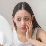 去黑眼圈最有效的方法