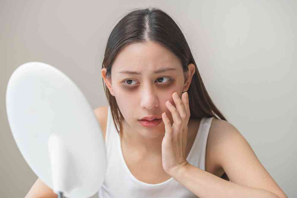 去黑眼圈最有效的方法